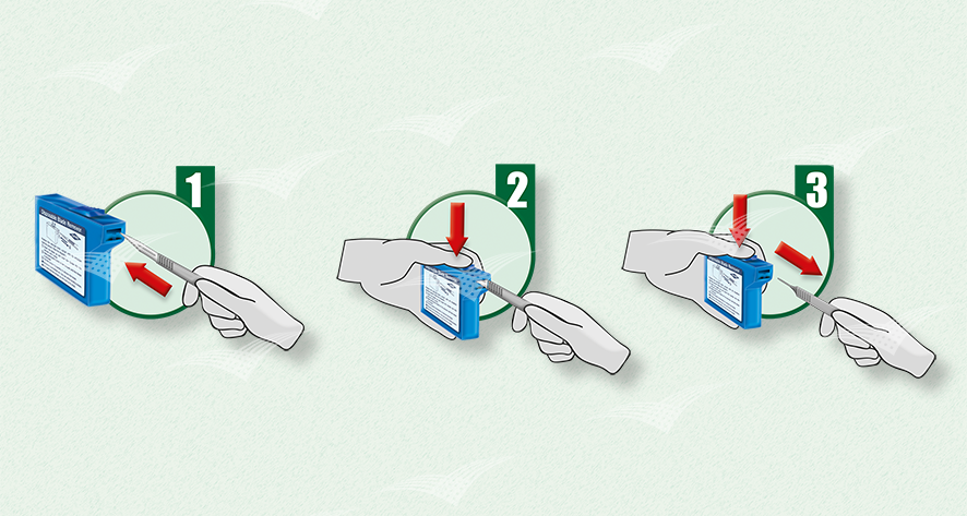 Skalpell Entferner Gross Erklärung